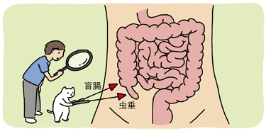 盲腸と虫垂の位置
