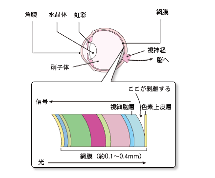 C[W}