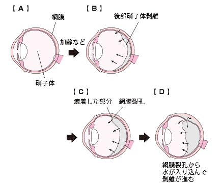 C[W}