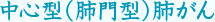 中心型（肺門型）肺がん